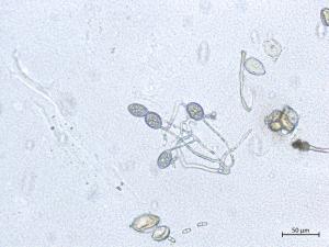 Phytophthora_infestans_4