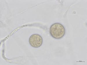 Phytophthora_nicotianae_2