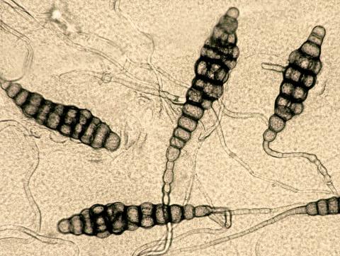 Alternaria_brassicae_4