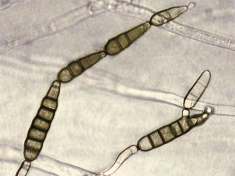 Alternaria_brassicicola_2