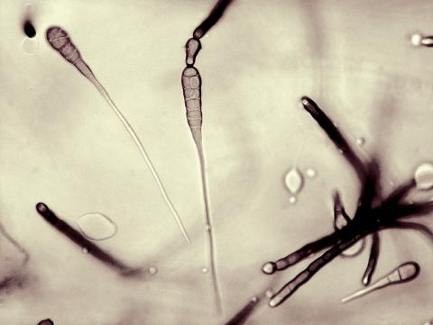 Alternaria_cichorii_1