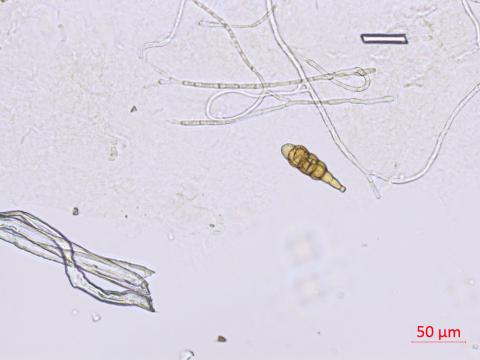 Alternaria_japonica_2