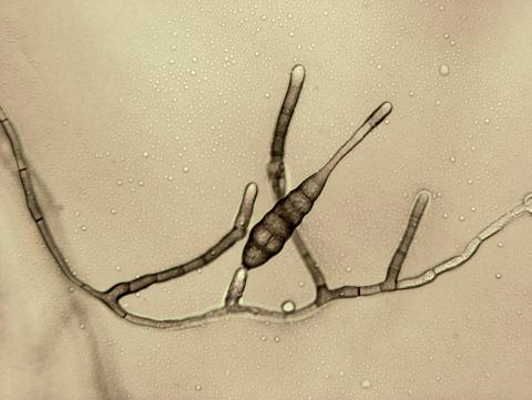 Alternaria_tagetica_1