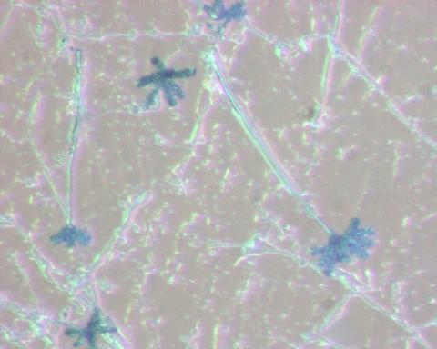 Chromelosporium-1_LQ