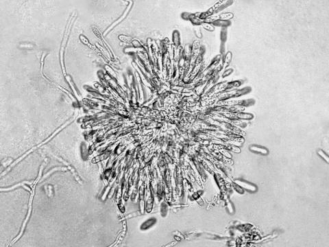 Colletotrichum_gloeosporioides_1