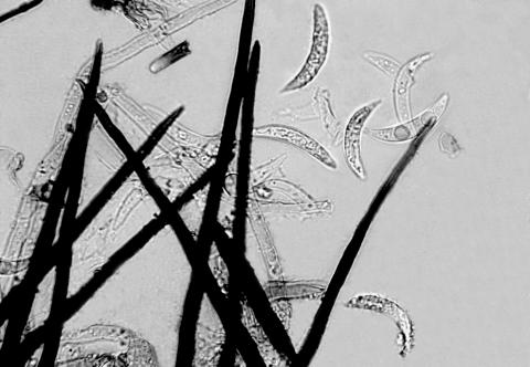 Colletotrichum_graminicola_1