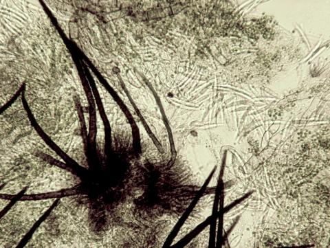 Colletotrichum_truncatum_1