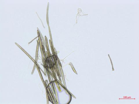 Corynespora_cassiicola_1