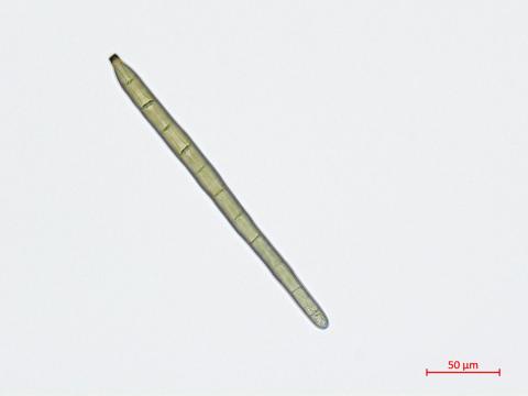 Corynespora_cassiicola_2