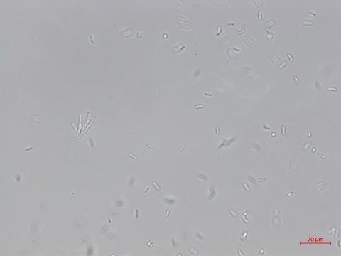 Cytospora_leucostoma_1