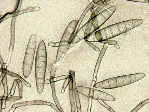 Exserohilum_turcicum_1