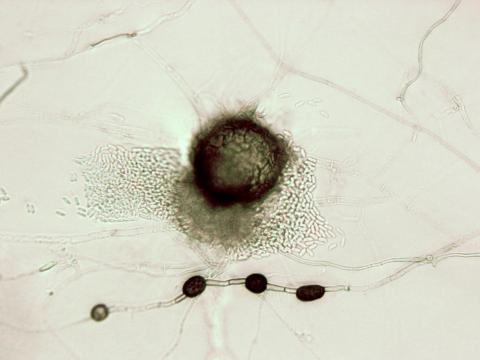 Ascochyta_sp_4