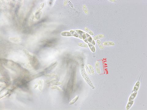 Glomerella_sp_1