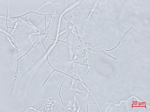 Microdochium_sp_1