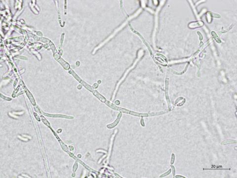 Microdochium_sp_3