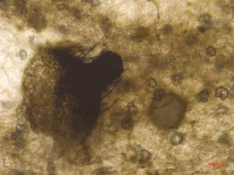 Physalospora_vaccinii_3