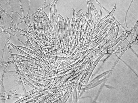 Fusarium_graminearum_1
