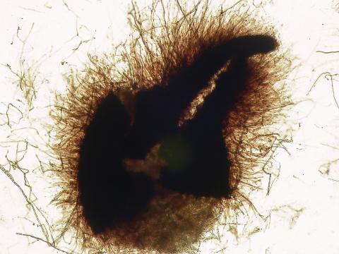 Gaeumannomyces_sp_2