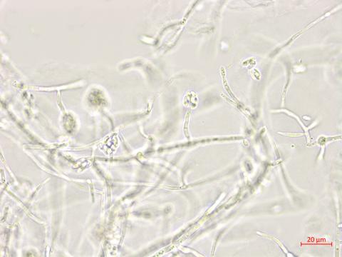Plectosporium_tabacinum_1