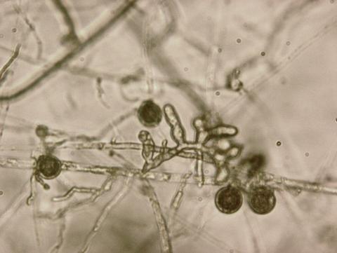 Pythium_aphanidermatum_1