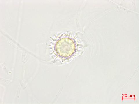 Pythium_uncinulatum_3