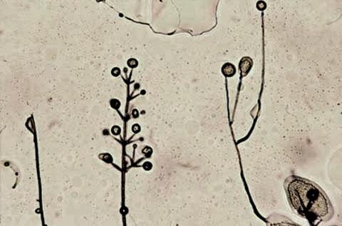 Verticillium_dahliae_4