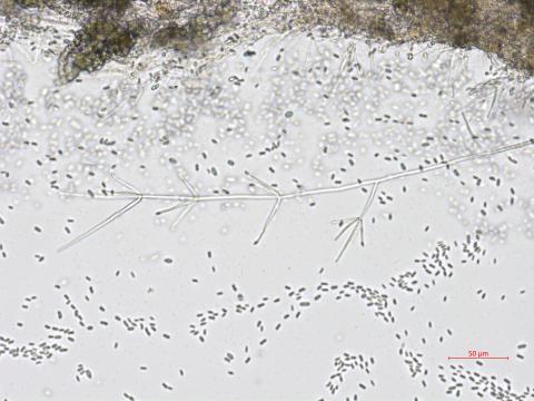 Verticillium_dahliae_3