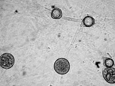 Pythium_irregulare_1