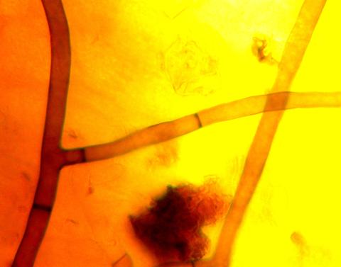 Rhizoctonia_solani_2