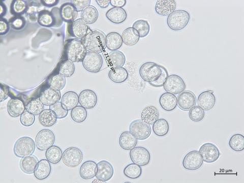 Albugo_candida_2