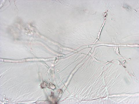 Sclerotium_cepivorum_4