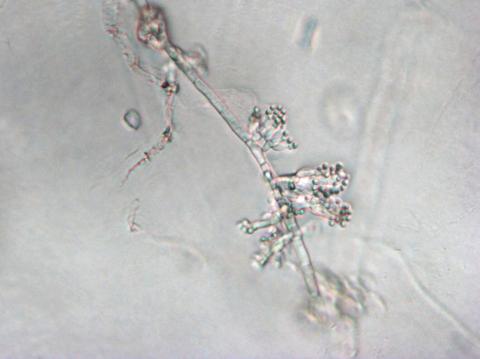 Sclerotium_cepivorum_3