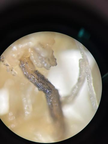 Berkeleyomyces_basicola_5