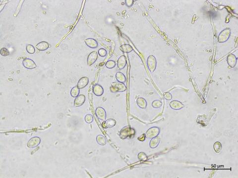 Phytophthora_infestans_5