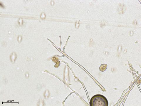 Phytophthora_infestans_3