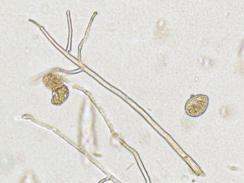 Phytophthora_infestans_4