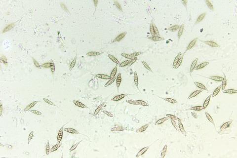 Alternaria_sp_4