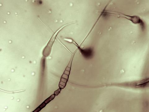 Alternaria_cichorii_5