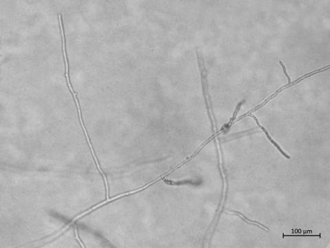 Aphanomyces_euteiches_2
