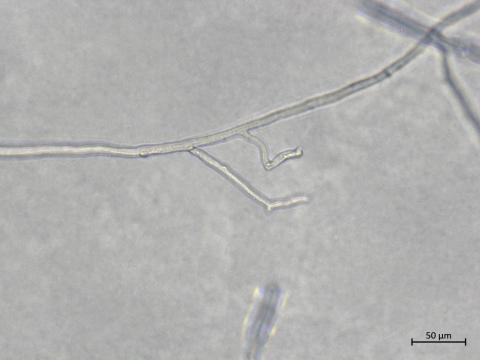 Aphanomyces_euteiches_4