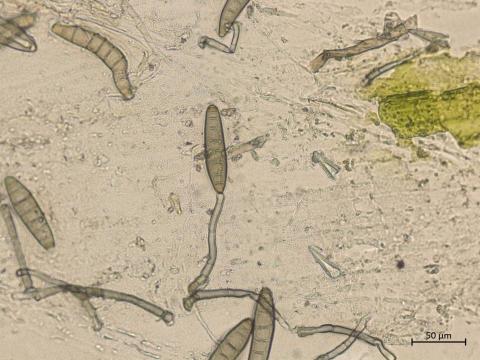 Bipolaris_sorokiniana_5