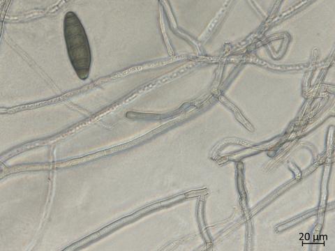 Bipolaris_sorokiniana_2