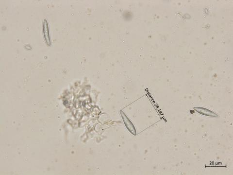 Botryosphaeria_dothidea_4