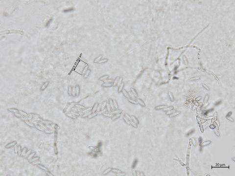 Colletotrichum_acutatum_5
