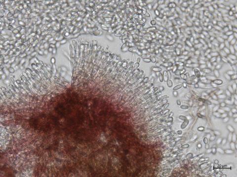 Colletotrichum_acutatum_6