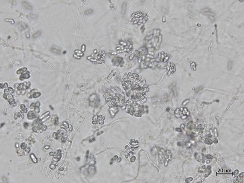 Colletotrichum_coccodes_8