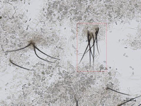 Colletotrichum_coccodes_6