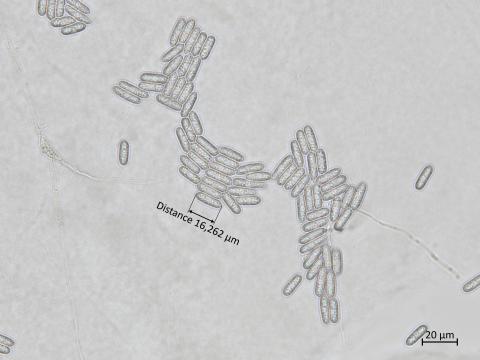 Colletotrichum_siamense_2