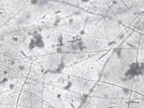 Globisporangium_irregulare_2