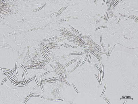 Neocosmospora_solani_2